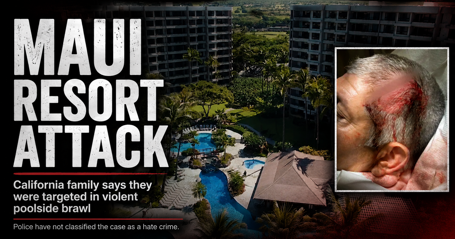“We’re Going to Beat Up the Haole Boys”: California Family Says Maui Vacation Ended in a 30-Person Resort Attack